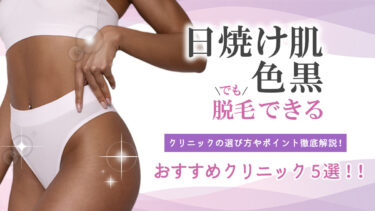 日焼け肌・色黒でも脱毛できるおすすめクリニック5選！！クリニックの選び方やポイント解説！